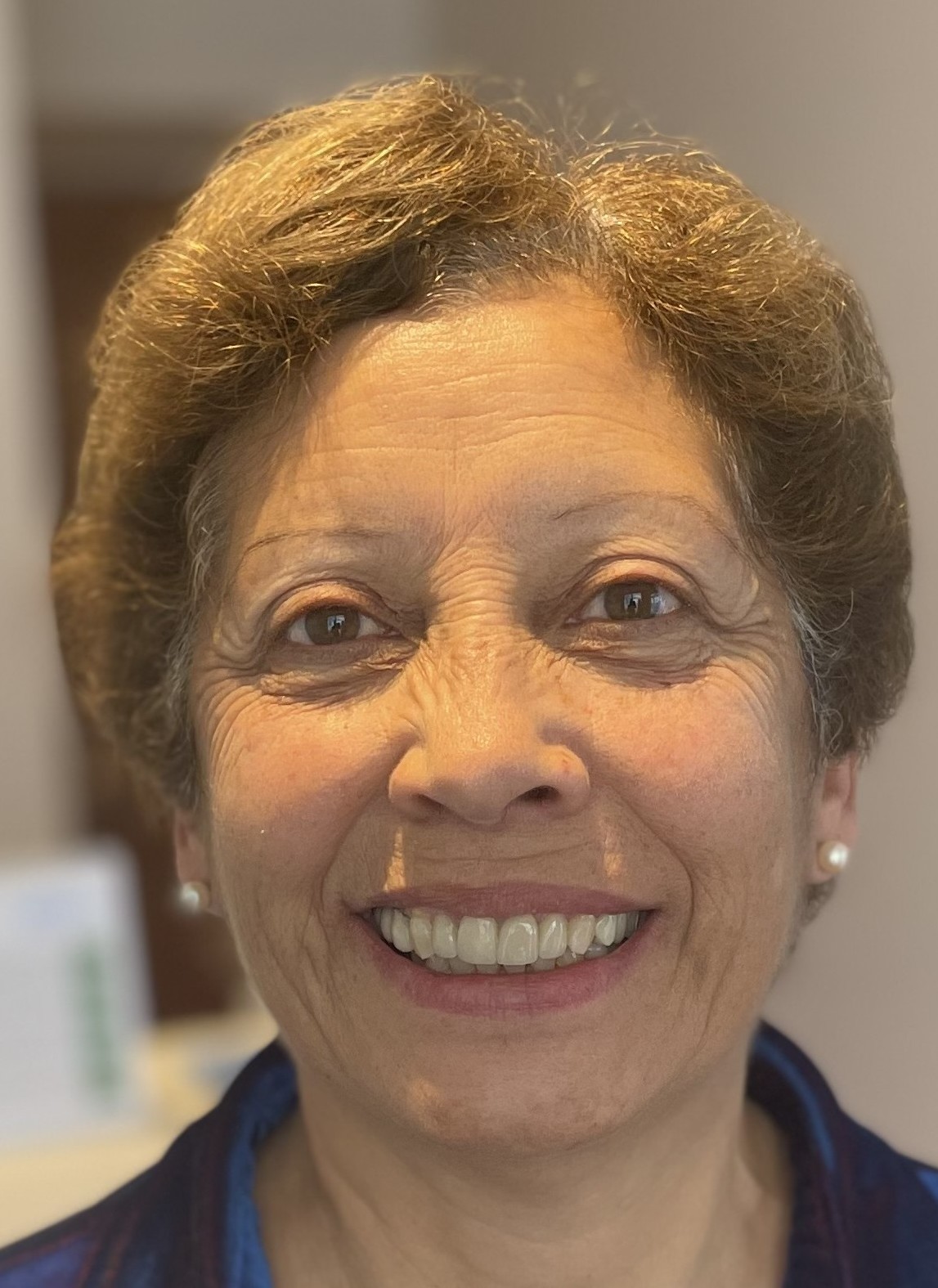 Paciente A - Después del tratamiento