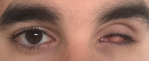 Paciente 1 - Estado inicial