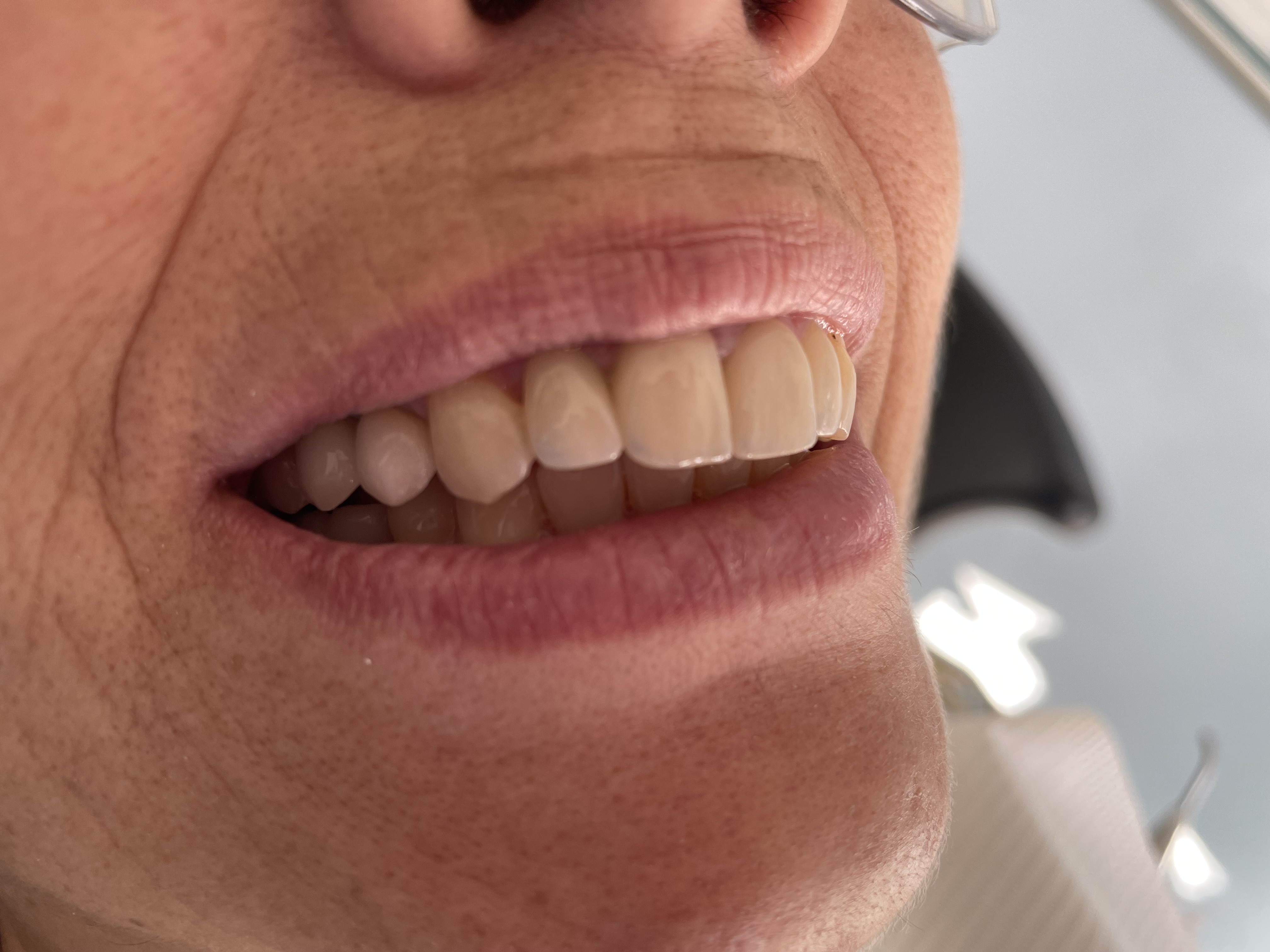 Paciente 7 - Después