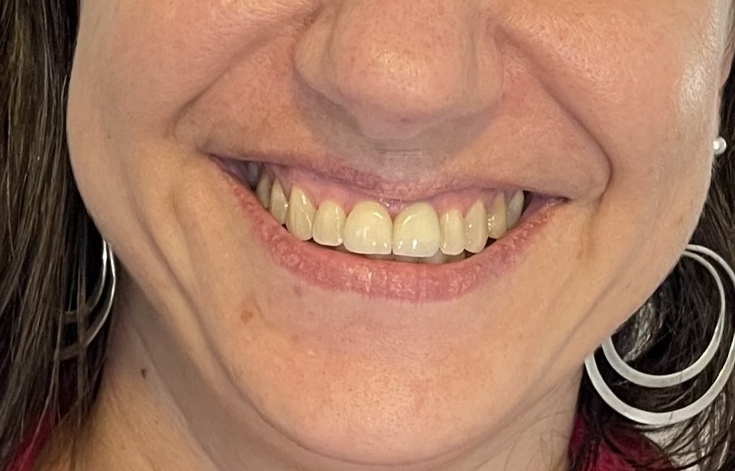 Paciente 5 - Después