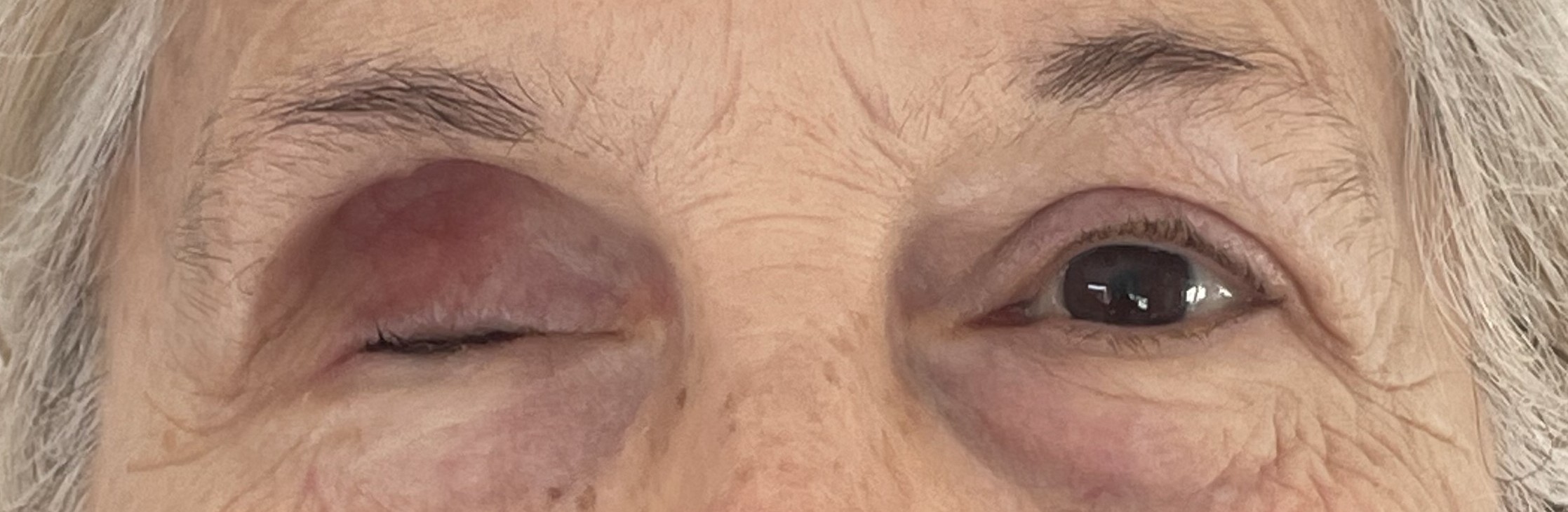 Paciente 5 - Estado inicial