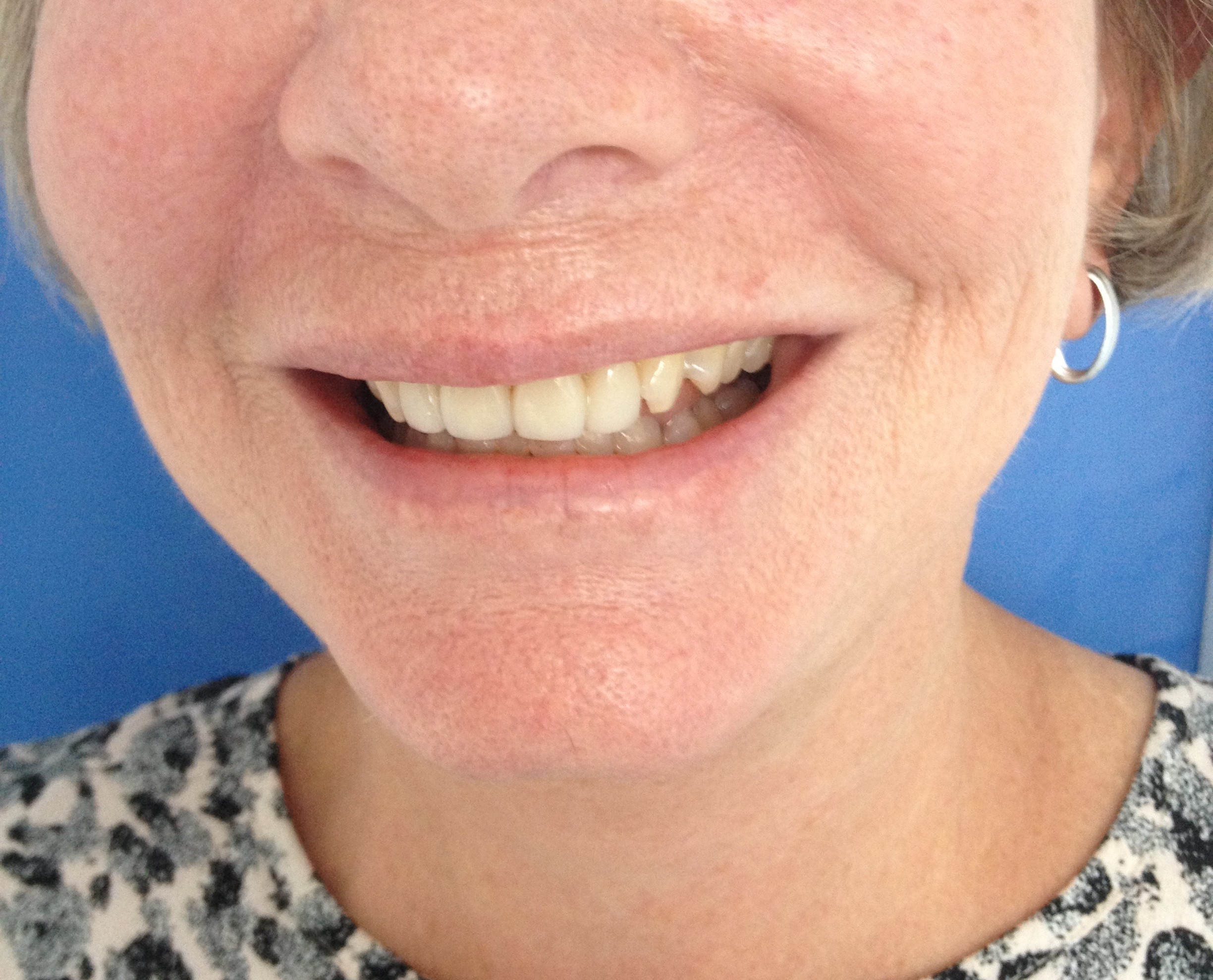 Paciente 9 - Después