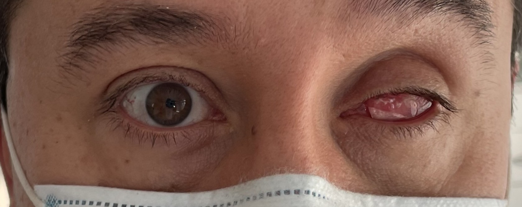 Paciente 7 - Estado inicial